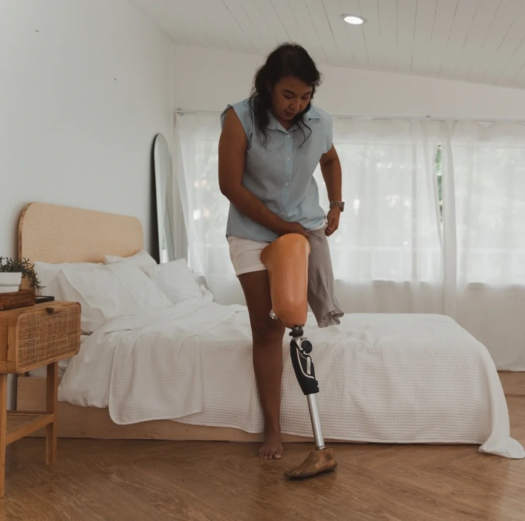 disabled women putting on a prosthetic leg in a disability support home